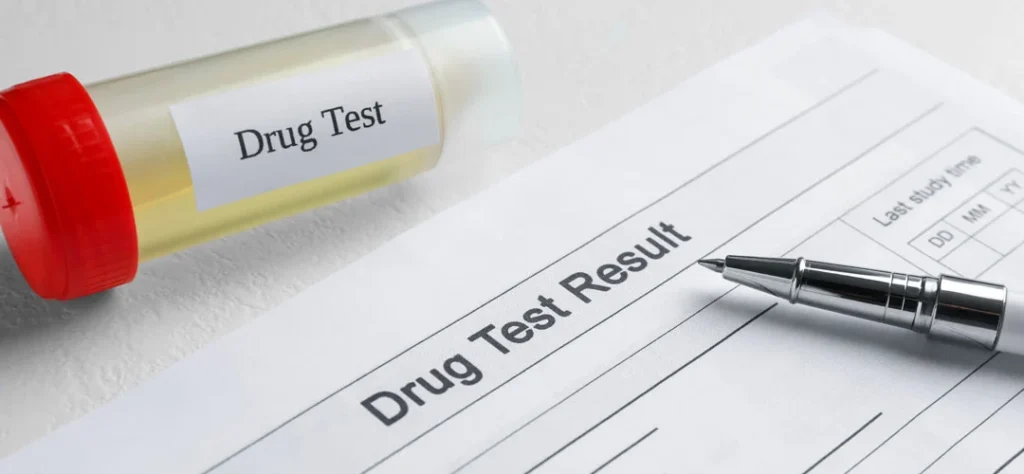 Routine Drug Tests